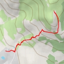 thumbnail for Сиамские близнецы