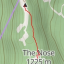 thumbnail for Upper Lip